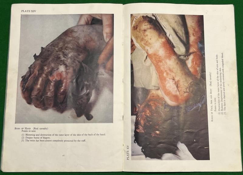 Atlas of Air-Raid Injuries — image 3