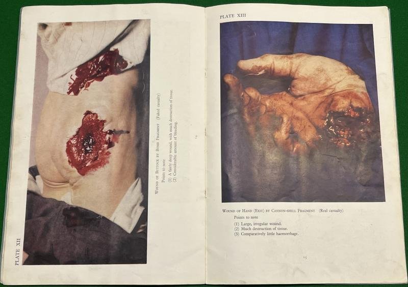 Atlas of Air-Raid Injuries — image 4