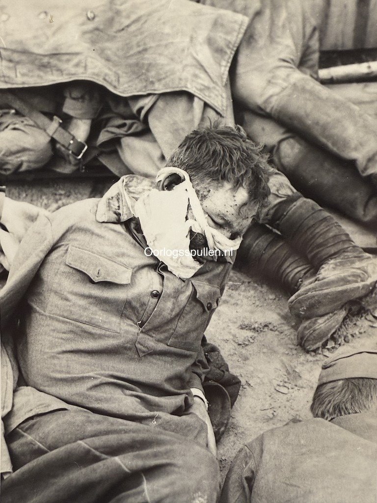 Original WWII German photo of wounded Soviet soldier — image 2