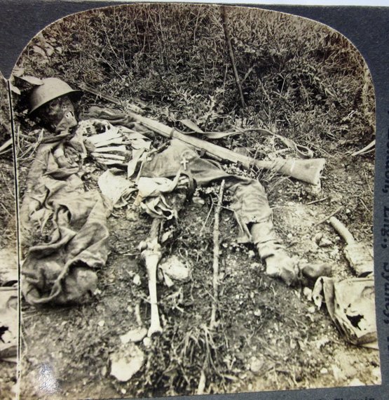 US WWI Keystone View Company Stereo Card, 'Human Wreckage' — image 2