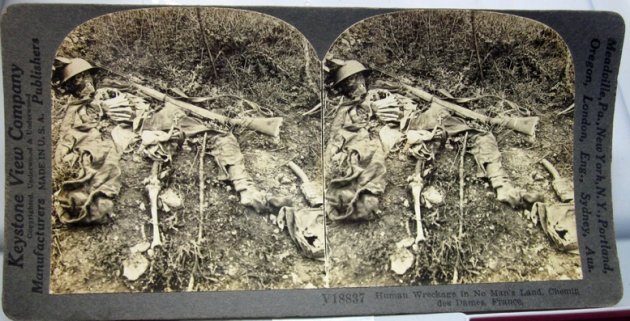 US WWI Keystone View Company Stereo Card, 'Human Wreckage' — image 3