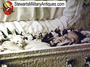  Post Mortem of Baby — image 3