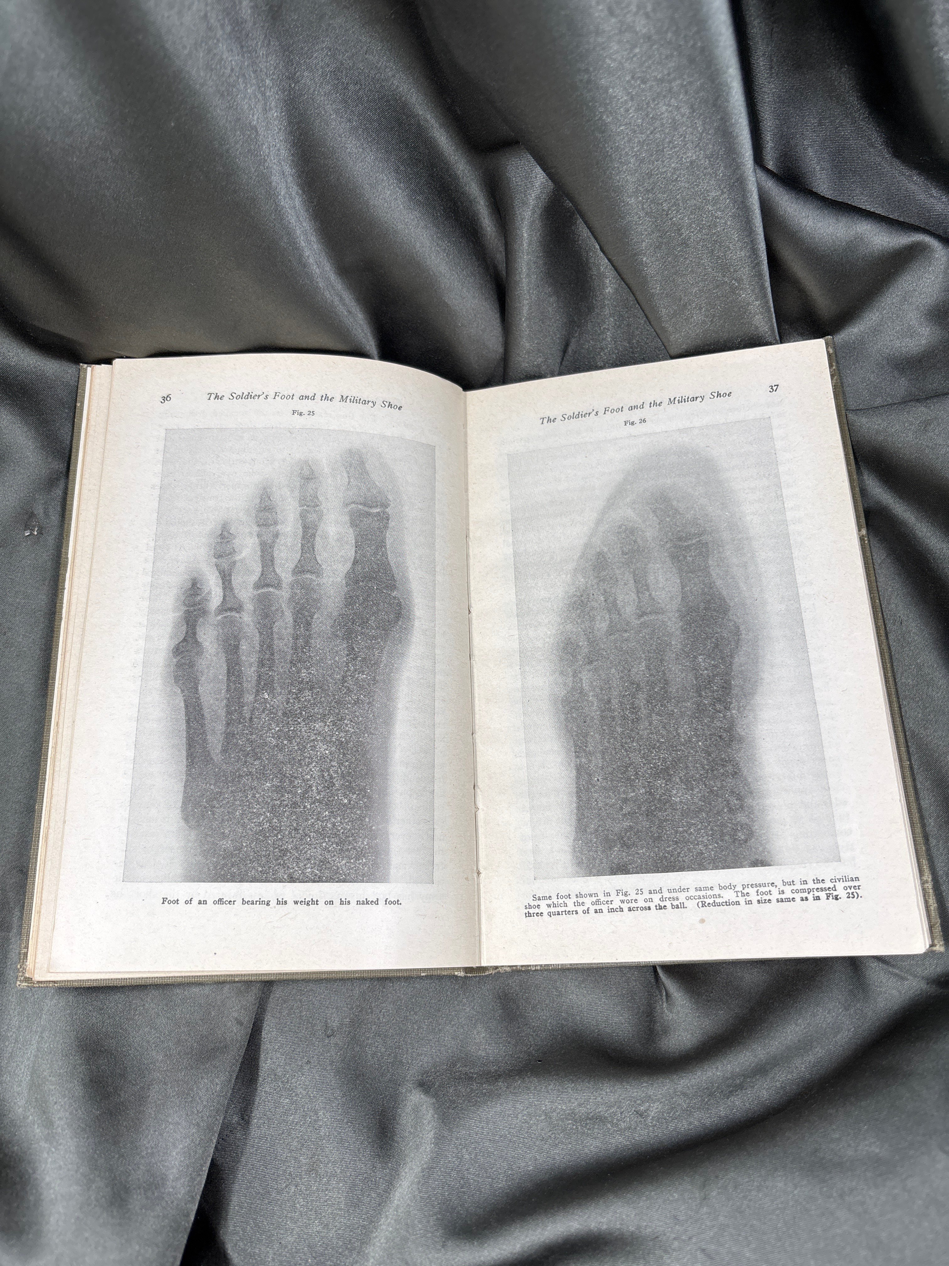 WWI ERA THE SOLDIERS FOOT AND THE MILITARY SHOE — image 4